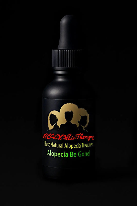 Alopecia           Be Gone!